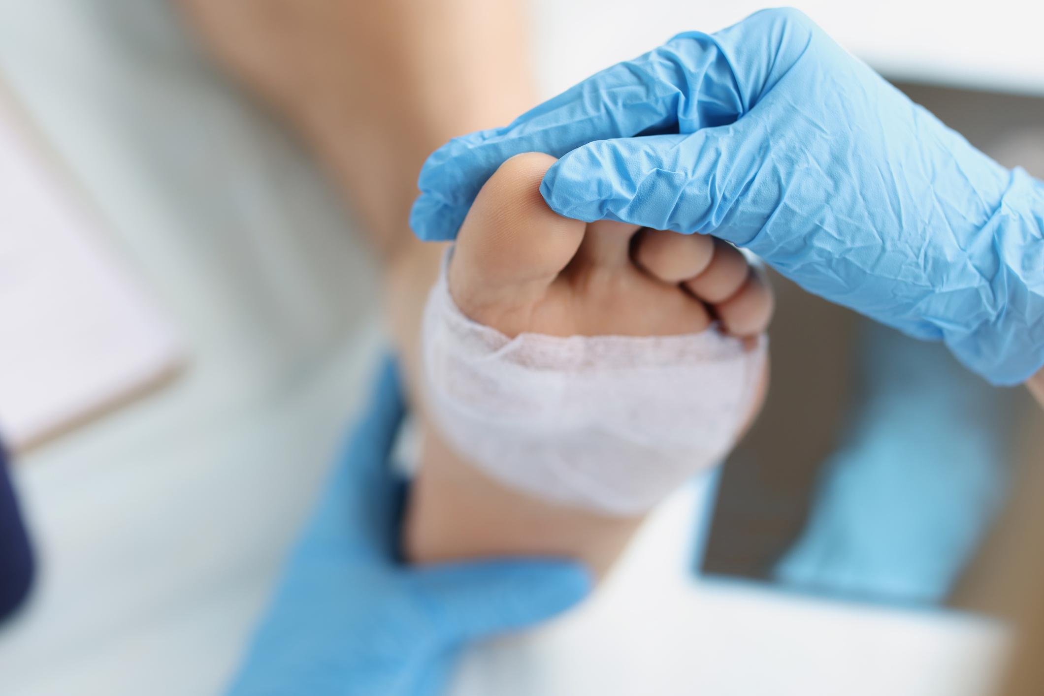 Diabetes-Related Foot Ulcers Short Course